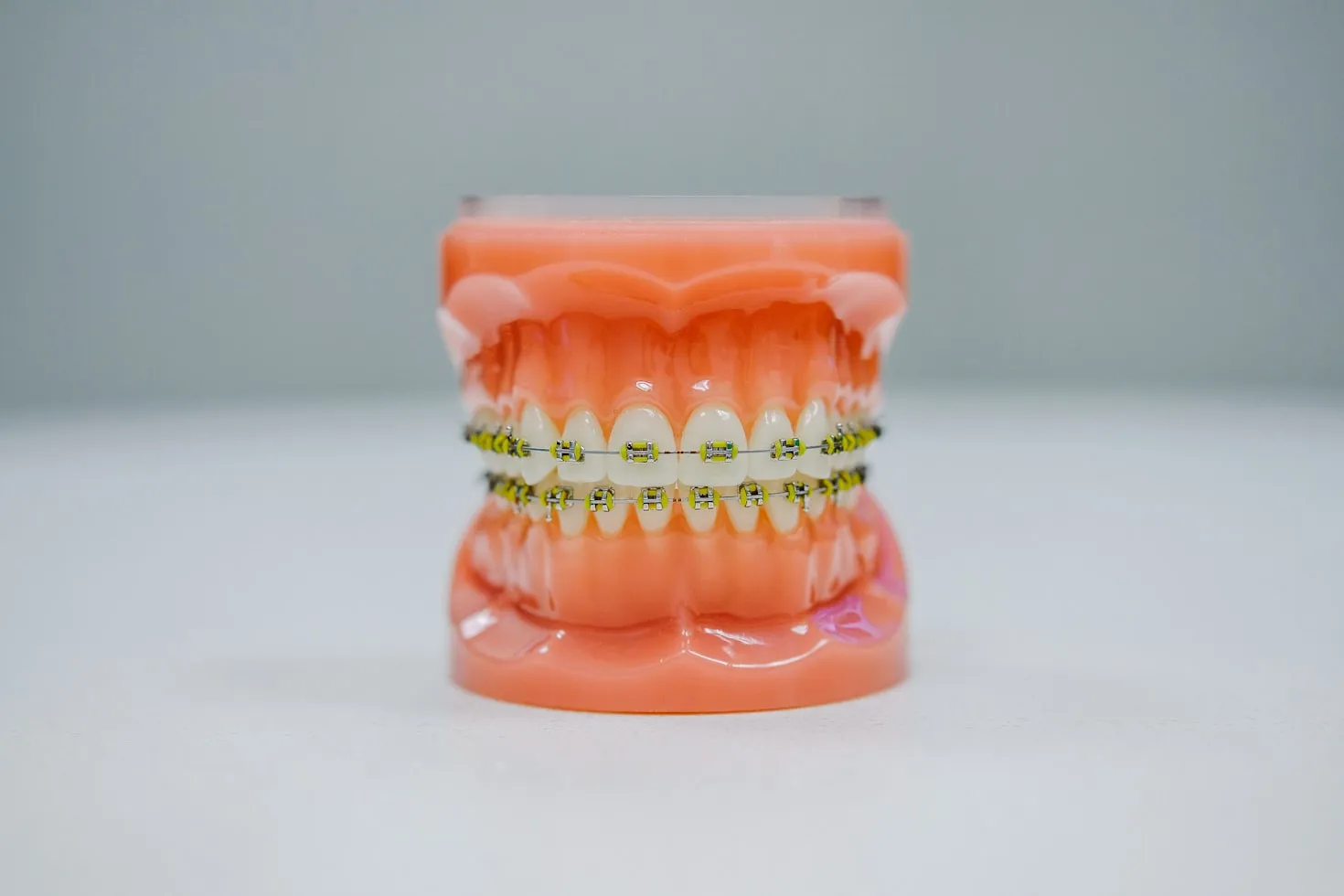 Illustration : Prothèses & orthodontie